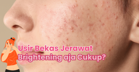 Mitos atau Fakta: Retinyl Bikin Iritasi?