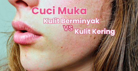 Mitos atau Fakta: Retinyl Bikin Iritasi?