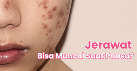Skin Barrier: Pondasi Kulit Sehat yang Baru Dicari Saat Bermasalah
